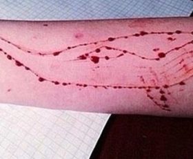 “Blue Whale”, annuncia l’imminente suicidio su facebook ma è uno scherzo, denunciato ragazzo di Serino