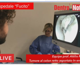 Tumore del colon retto asportato in endoscopia dall’equipe del professor Attilio Maurano a Mercato San Severino Al “Fucito” eseguito per la prima volta un intervento con la nuova tecnica non invasiva. Zulli: l’eccellenza della sanità anche al sud